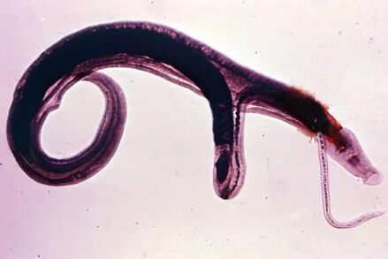 Schistosoma