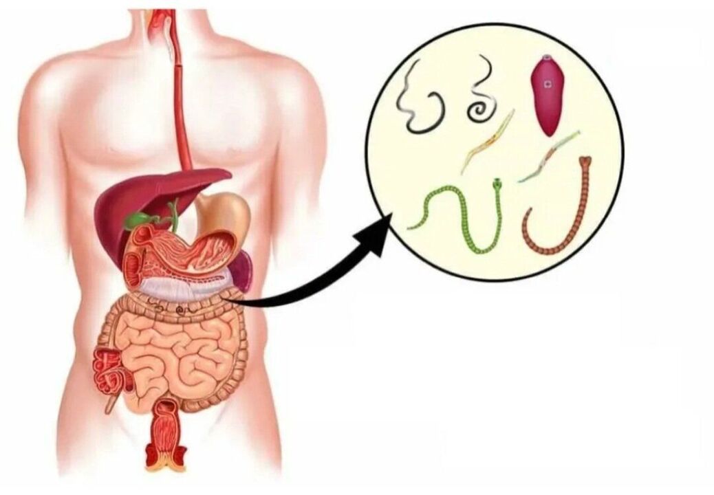 Parassiti in vari organi