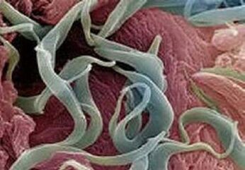 Sintomi e trattamento dei parassiti nel corpo umano