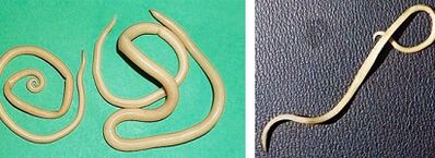 Quali parassiti può avere una persona