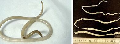 Tipi di parassiti nel corpo umano